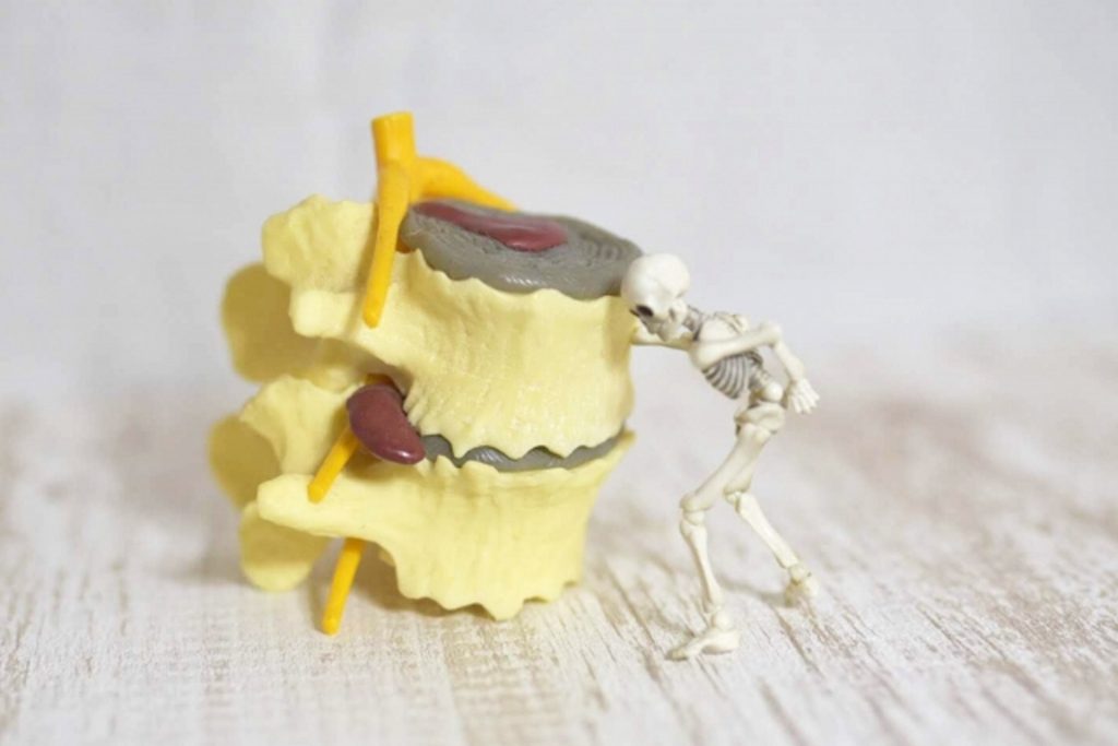 腰痛を引き起こす主な病気