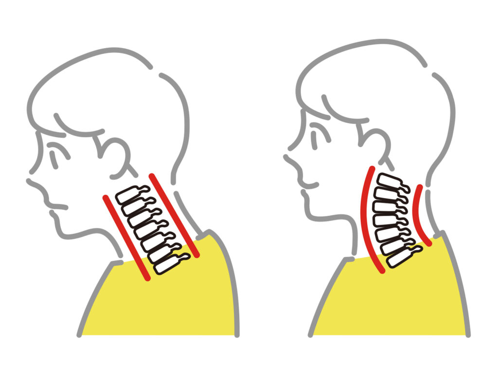 スマホ首の特徴