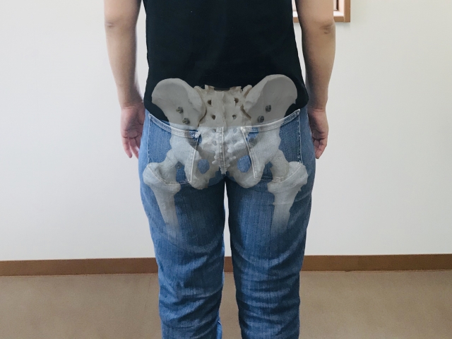 骨盤のゆがみ4タイプと肩こりの関係