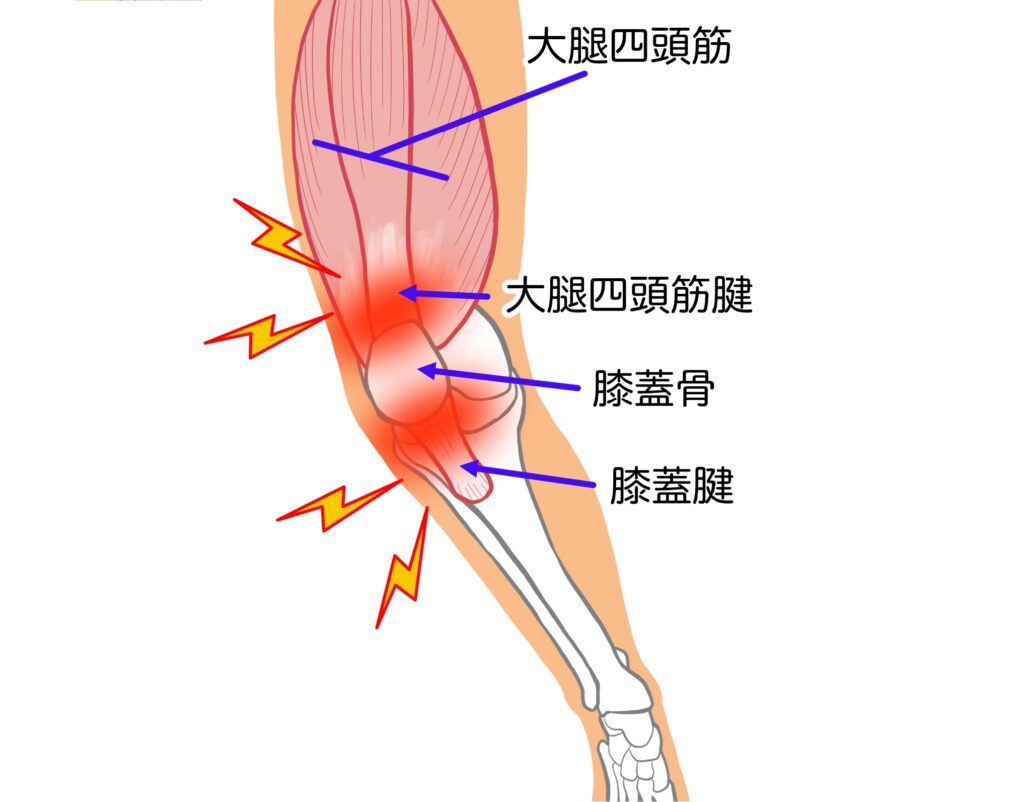 ひざの上または下